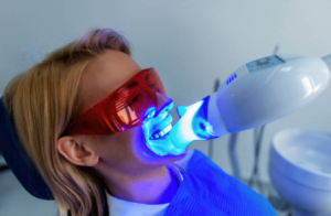 Lady having teeth whitening